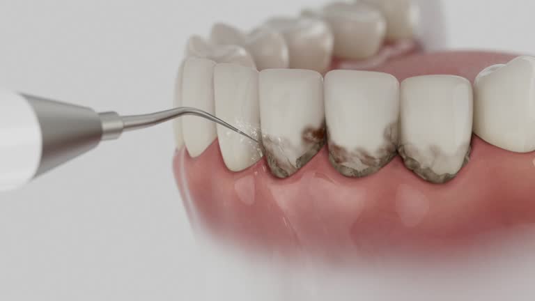Reliable Dental Implants contractor in Lambert, MS by Smile Center Dentistry